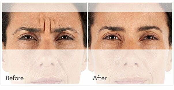 Comparison of skin before and after treatment