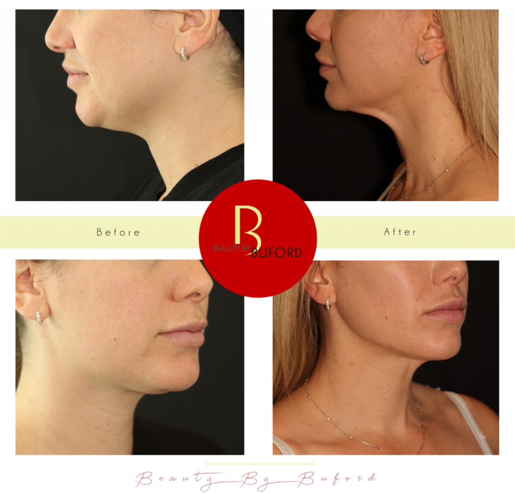 BEAUTY by BUFORD Image